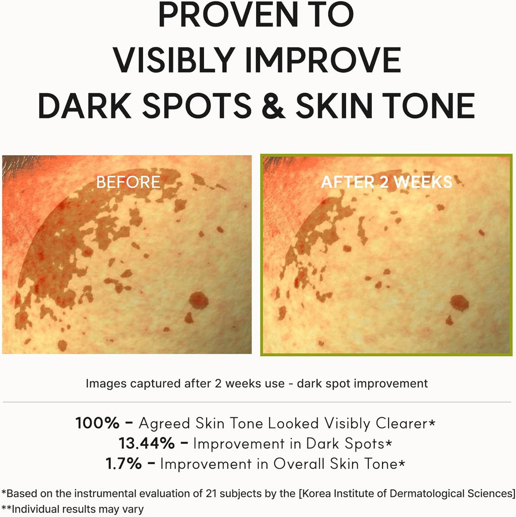 Arencia Vitamin C Booster Shot Serum with Glutathione, Niacinamide and Vitamin E for Dark Spot Care, Fine Lines & Wrinkles, Glass Skin, Korean Skincare 30ml/1.01 fl.oz