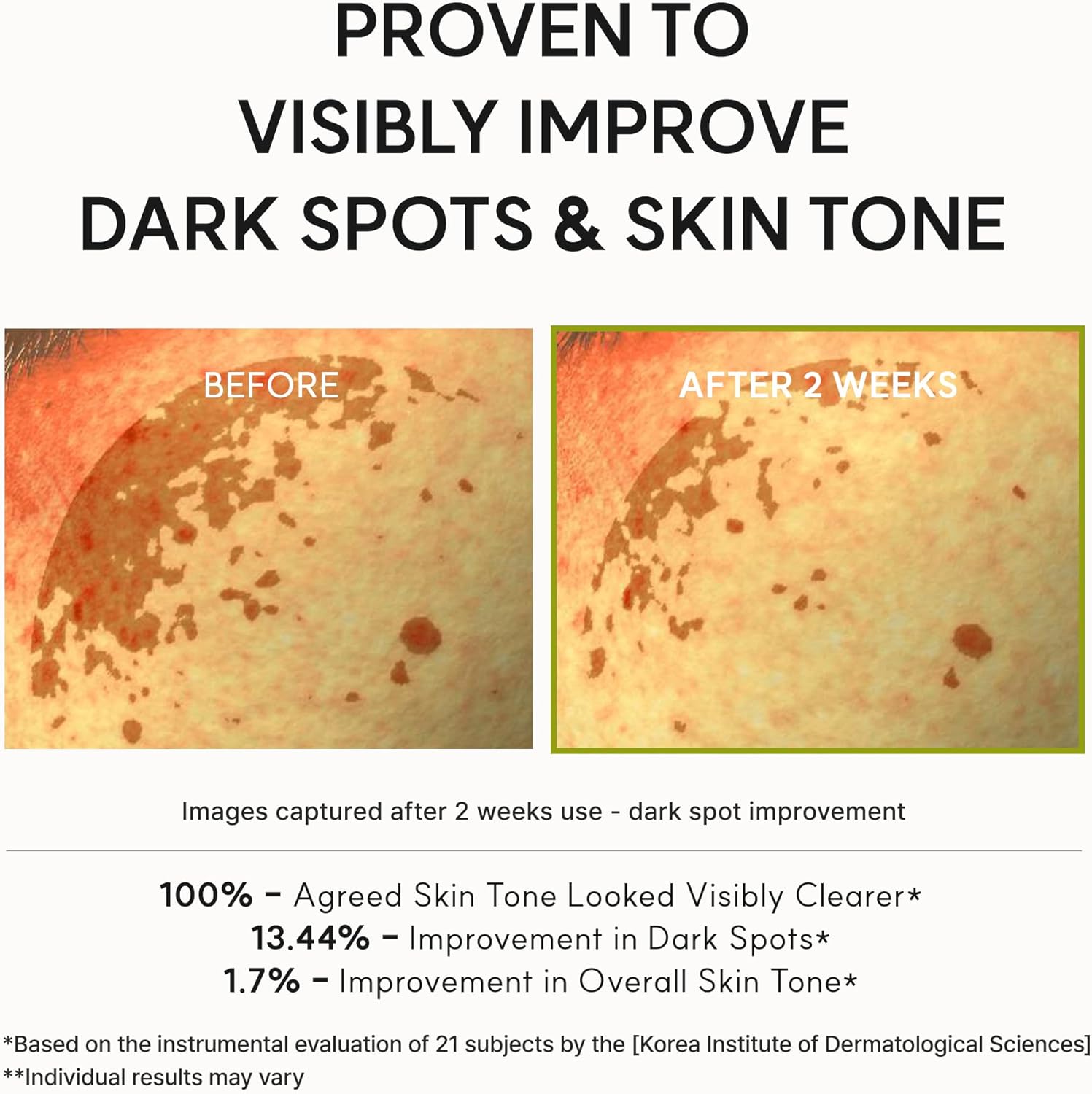 Arencia Vitamin C Booster Shot Serum with Glutathione, Niacinamide and Vitamin E for Dark Spot Care, Fine Lines & Wrinkles, Glass Skin, Korean Skincare 30ml/1.01 fl.oz